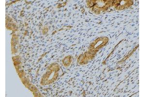 ABIN6276519 at 1/100 staining Human uterus tissue by IHC-P.