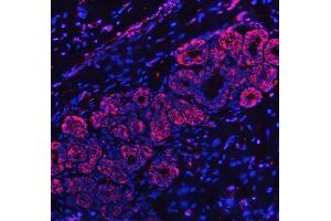 IF analysis of RPL32 using anti-RPL32 antibody (ABIN7602916).