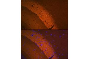 Immunofluorescence analysis of mouse brain using mGluR2 Rabbit mAb (ABIN1682570, ABIN3017965, ABIN3017966 and ABIN7101551) at dilution of 1:100 (40x lens). (GRM2 antibody)