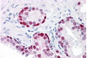 Human Prostate: Formalin-Fixed, Paraffin-Embedded (FFPE) (SOX9 antibody  (AA 400-510))