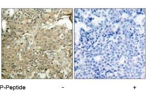 Image no. 1 for anti-Cofilin 1 (CFL1) (pSer3) antibody (ABIN196855) (Cofilin antibody  (pSer3))