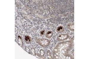 Immunohistochemical staining of human small intestine with TOX4 polyclonal antibody  shows strong cytoplasmic positivity in paneth cells.