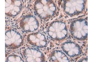 DAB staining on IHC-P; Samples: Human Intestine Tissue (RNASET2 antibody  (AA 25-256))