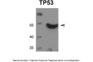 WB Suggested Anti-TP53 Antibody  Titration: 0. (p53 antibody  (C-Term))