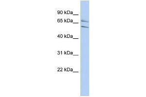 WB Suggested Anti-PHF21A Antibody Titration:  0. (PHF21A antibody  (N-Term))