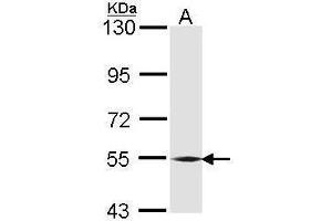 WB Image Sample (30 ug of whole cell lysate) A: A431 , 7. (BMP6 antibody)
