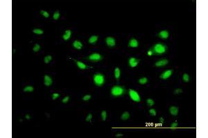 Immunofluorescence of monoclonal antibody to PHF1 on HeLa cell. (PHF1 antibody  (AA 2-100))