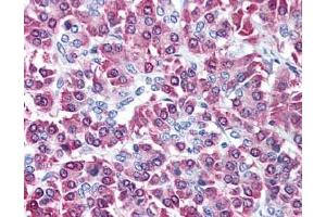 Image no. 3 for anti-Cbl proto-oncogene C (CBLC) (AA 444-458) antibody (ABIN401316) (CBLC antibody  (AA 444-458))