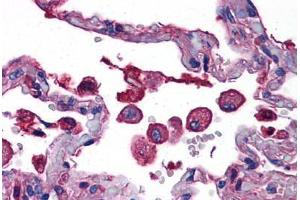 Human Lung: Formalin-Fixed, Paraffin-Embedded (FFPE) (TLR7 antibody  (AA 465-483))