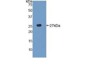 Detection of Recombinant TLR6, Human using Polyclonal Antibody to Toll Like Receptor 6 (TLR6) (TLR6 antibody  (AA 608-796))
