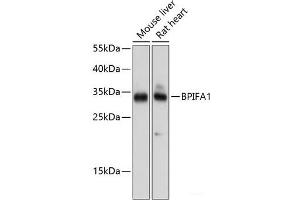 Western blot analysis of extracts of various cell lines using BPIFA1 Polyclonal Antibody at dilution of 1:1000. (BPIFA1 antibody)