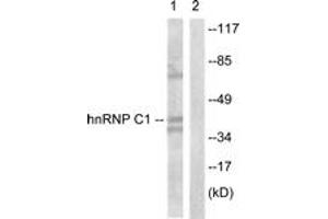 Western blot analysis of extracts from HuvEc cells, treated with EGF 200ng/ml 5', using hnRNP C1/2 (Ab-260) Antibody. (HNRNPC antibody  (AA 231-280))