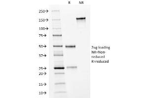 SDS-PAGE Analysis Purified HER-2 Mouse Monoclonal Antibody (HRB2/282).