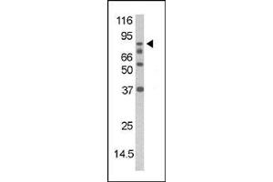 The anti-Phospho-DAXX- Pab  is used in Western blot to detect Phospho-DAXX- in mouse thymus tissue lysate (DAXX antibody  (pSer213))