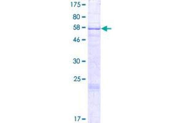 NARG1L Protein (AA 1-311) (GST tag)