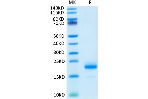 Human IL-4 on Tris-Bis PAGE under reduced condition. (IL-4 Protein (AA 25-153))
