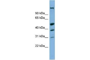 WB Suggested Anti-CREBZF Antibody Titration:  0. (CREBZF antibody  (Middle Region))