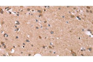 Immunohistochemistry of paraffin-embedded Human brain tissue using GPC6 Polyclonal Antibody at dilution 1:40 (Glypican 6 antibody)