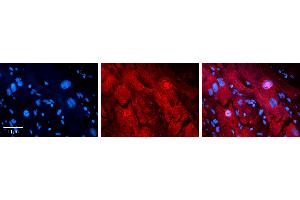 Rabbit Anti-MLX Antibody   Formalin Fixed Paraffin Embedded Tissue: Human heart Tissue Observed Staining: Cytoplasmic, nucleus Primary Antibody Concentration: 1:100 Other Working Concentrations: N/A Secondary Antibody: Donkey anti-Rabbit-Cy3 Secondary Antibody Concentration: 1:200 Magnification: 20X Exposure Time: 0. (MLX antibody  (N-Term))