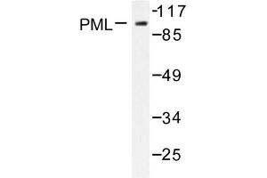 Image no. 1 for anti-Promyelocytic Leukemia (PML) antibody (ABIN271787)