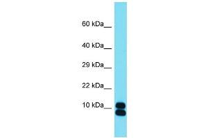 Host: Rabbit  Target Name: Rpl35  Sample Tissue: Mouse Small Intestine lysates  Antibody Dilution: 1. (RPL35 antibody  (Middle Region))