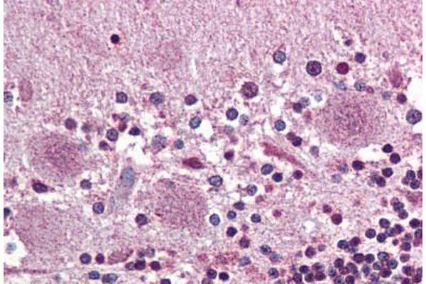 Prokineticin Receptor 2 antibody  (N-Term)