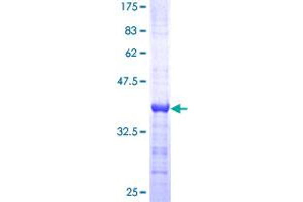 DCT Protein (AA 61-160) (GST tag)