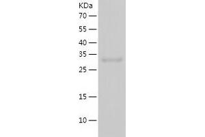 Western Blotting (WB) image for Melanoma Antigen Family A, 4 (MAGEA4) (AA 1-317) protein (His tag) (ABIN7123889) (MAGEA4 Protein (AA 1-317) (His tag))