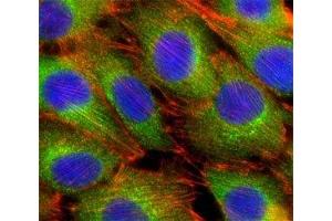 Fluorescent confocal image of C2C12 cells stained with AKT2 antibody at 1:25. (AKT2 antibody  (AA 416-444))