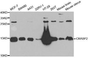 Western blot analysis of extracts of various cell lines, using CRABP2 antibody. (CRABP2 antibody  (AA 22-94))