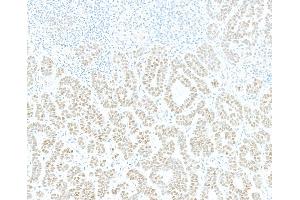 Immunohistochemistry (IHC) image for anti-Jun Dimerization Protein 2 (JDP2) (AA 50-100) antibody (ABIN7795635)