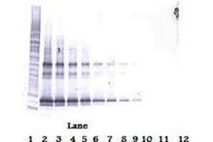 Image no. 2 for anti-Tumor Necrosis Factor (Ligand) Superfamily, Member 14 (TNFSF14) antibody (Biotin) (ABIN465441) (TNFSF14 antibody  (Biotin))
