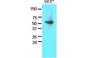 Western Blotting (WB) image for anti-Glucose-6-Phosphate Dehydrogenase (G6PD) (AA 35-506) antibody (ABIN400862) (Glucose-6-Phosphate Dehydrogenase antibody  (AA 35-506))