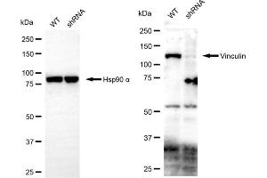 Western blotting analysis using vinculin antibody (ABIN7800841). (Vinculin antibody)