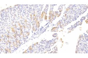 Detection of ATG7 in Mouse Stomach Tissue using Polyclonal Antibody to Autophagy Related Protein 7 (ATG7) (ATG7 antibody  (AA 477-698))