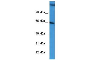WB Suggested Anti-BCAM  Antibody Titration: 0. (BCAM antibody  (C-Term))
