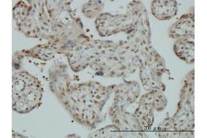 Image no. 1 for anti-Cullin-Associated and Neddylation-Dissociated 1 (CAND1) (AA 1-101) antibody (ABIN599270) (CAND1 antibody  (AA 1-101))