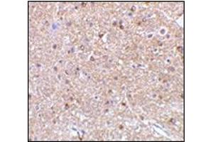 Immunohistochemistry of NogoA in mouse brain tissue with this product at 2. (Reticulon 4 antibody  (Isoform 1))