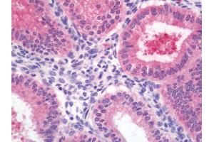 anti-DnaJ (Hsp40) Homolog, Subfamily C, Member 10 (DNAJC10) (AA 688-794) antibody