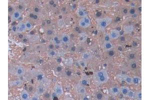 Detection of LCNL1 in Rat Liver Tissue using Polyclonal Antibody to Lipocalin Like Protein 1 (LCNL1) (LCNL1 antibody)
