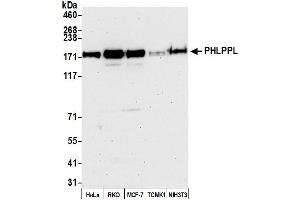 Western Blotting (WB) image for anti-PH Domain and Leucine Rich Repeat Protein Phosphatase 2 (PHLPP2) (C-Term) antibody (ABIN7450565)