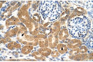 Human kidney (TMEM69 antibody  (Middle Region))