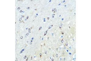 Immunohistochemistry of paraffin-embedded mouse brain using FUT4 Rabbit pAb (ABIN7267274) at dilution of 1:100 (40x lens). (CD15 antibody  (AA 200-300))
