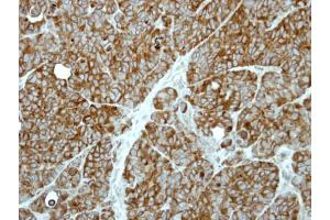 IHC-P Image Immunohistochemical analysis of paraffin-embedded SW480 xenograft, using MP1, antibody at 1:500 dilution. (MAPKSP1 antibody)