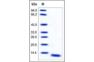 Human S100A8, Tag Free on SDS-PAGE under reducing (R) condition. (S100A8 Protein (AA 1-93))