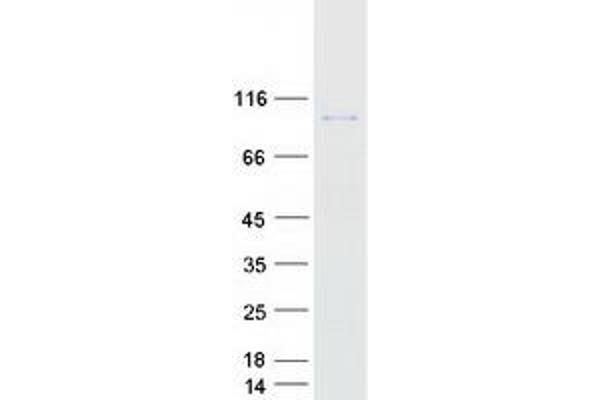 TBC1D16 Protein (Myc-DYKDDDDK Tag)