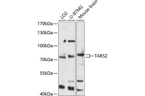 TARS2 antibody  (AA 100-400)