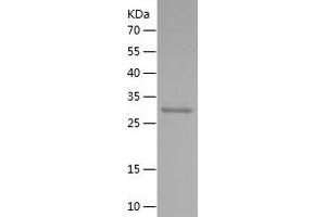 SLC34A2 Protein (AA 1-100) (His-IF2DI Tag)