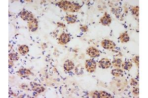 Formalin-fixed and paraffin embedded human kidney labeled with Anti-PBEF1 Polyclonal Antibody, Unconjugated  at 1:200 followed by conjugation to the secondary antibody and DAB staining. (NAMPT antibody  (AA 301-400))