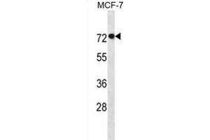 AG Antibody (N-term) (ABIN1881050 and ABIN2838685) western blot analysis in MCF-7 cell line lysates (35 μg/lane).